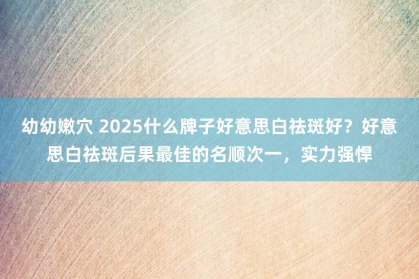 幼幼嫩穴 2025什么牌子好意思白祛斑好？好意思白祛斑后果最佳的名顺次一，实力强悍